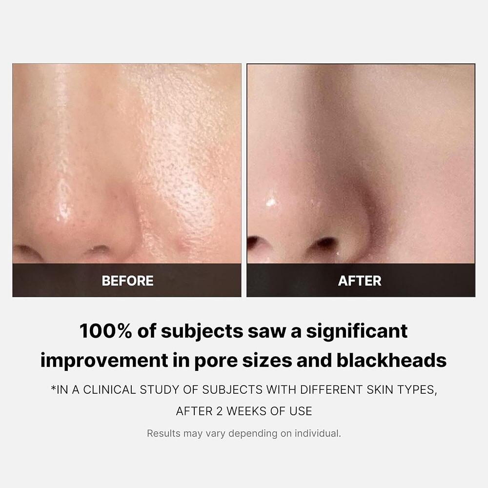 Zero Pore Pads (70 Pads)